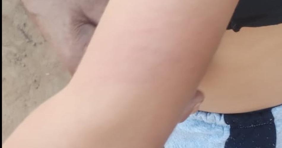 Mujer atacoacute a su hijo de 6 antildeos salvajemente y fue denunciada