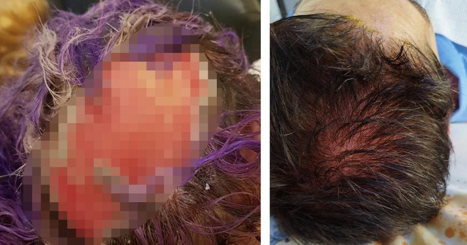 Bomberos alertan sobre los riesgos de usar tintes en nintildeo