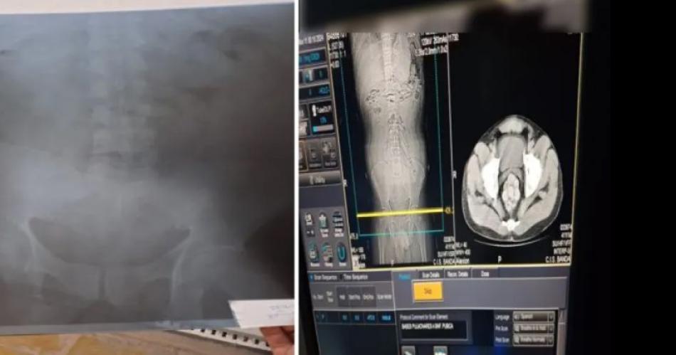 ASISTENCIA Al cierre de la presente edición la víctima se encontraba internada en el Hospital Regional con pronóstico reservado