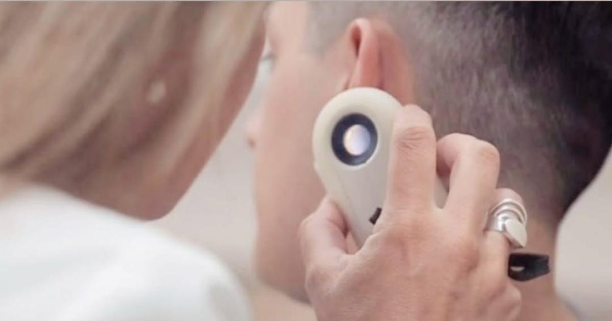 Cómo prevenir el cncer de piel