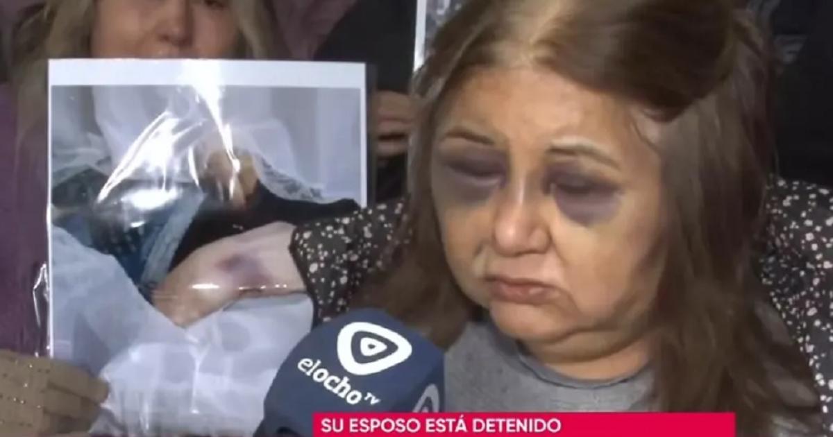 Sobreviviente de un femicidio habloacute tras el brutal crimen- Habiacutea tenido un ACV y estaba recuperando fuerzas
