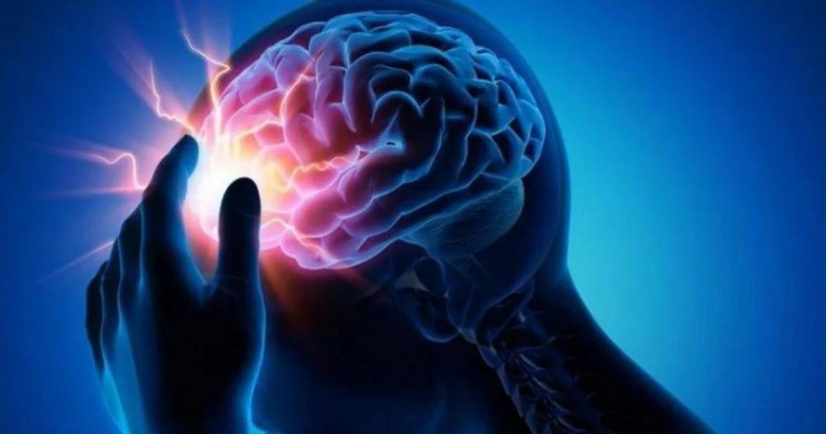 ADVERTENCIA El ACV no avisa Se manifiesta de manera sbita