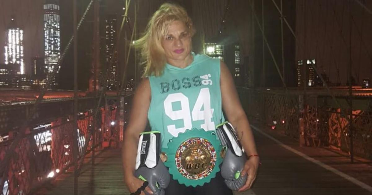 Mejoría de Locomotora Oliveras- abrió los ojos y respira por sí misma