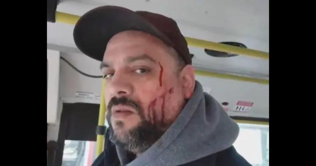 VIDEO DEL HORROR Quisieron viajar con un certificado trucho y le desfiguraron la cara a un colectivero