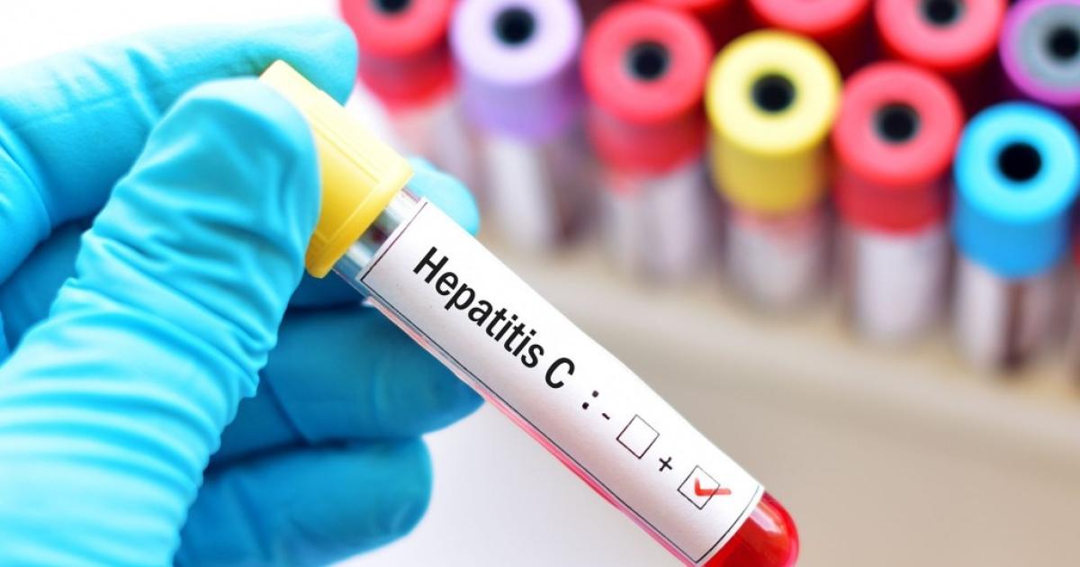 DIAGNÓSTICO El testeo es la nica forma de saber si alguien tiene hepatitis C