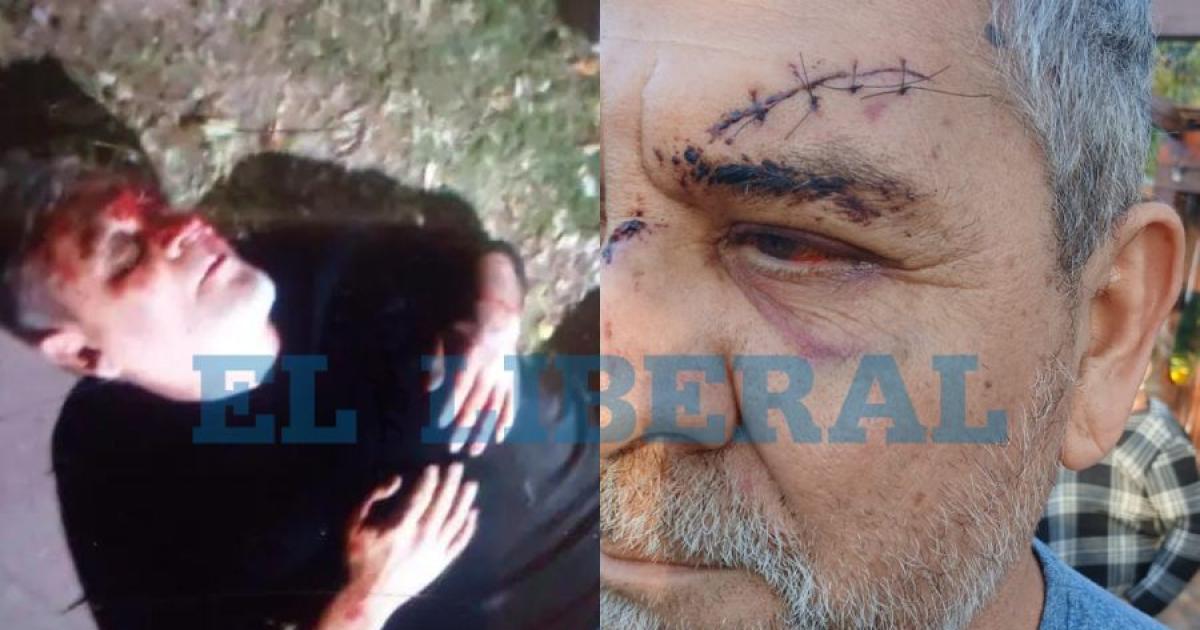 Brutal asalto al comisionado de El Zanjón en Ciudad del Niño- sufrió una lesión en el crneo