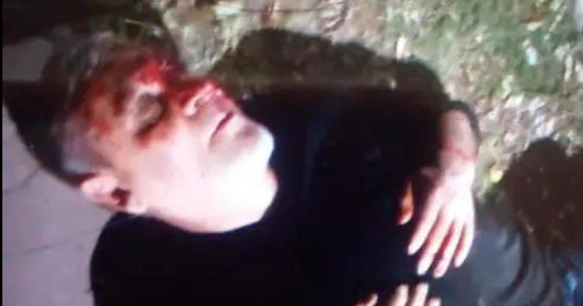 VIOLENCIA Las imgenes muestran las heridas y golpes que recibió el jefe comunal