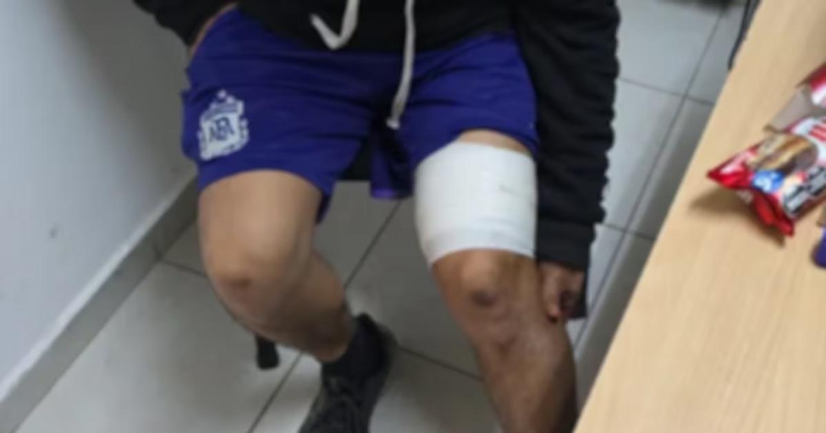 Violento ataque por celos- apuñaló a un cliente de su exnovia tatuadora