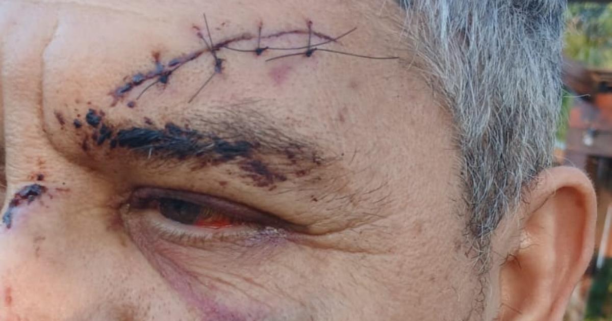 ASALTO El funcionario resultó con heridas de consideración