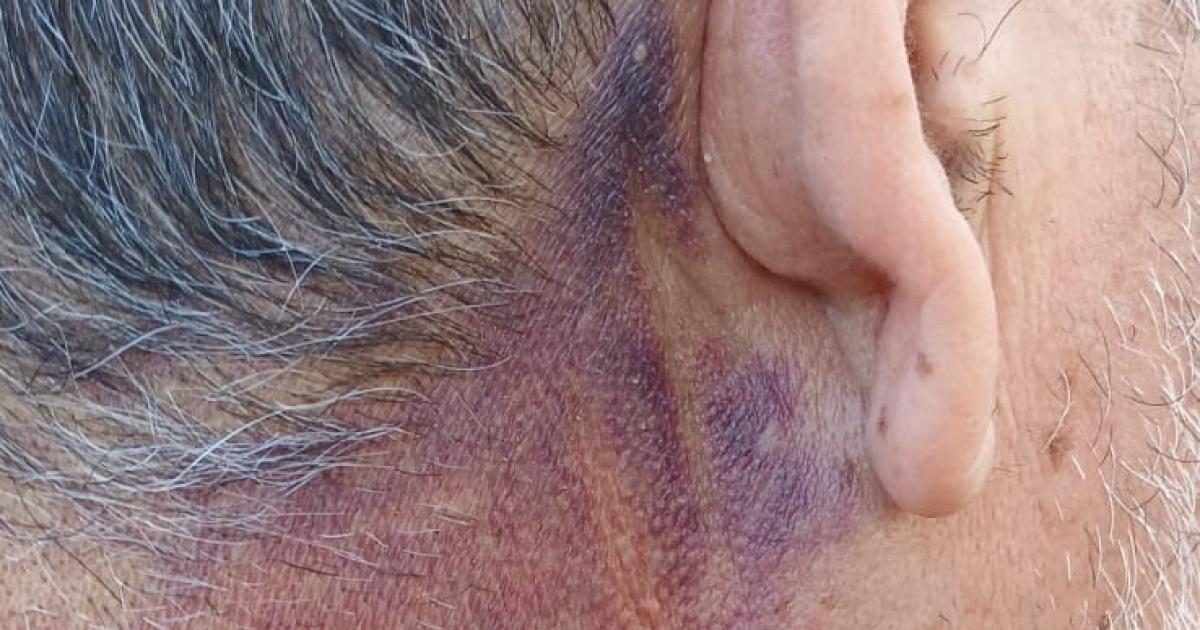 Comisionado municipal dice que sufrioacute un violento asalto en la viacutea puacuteblica