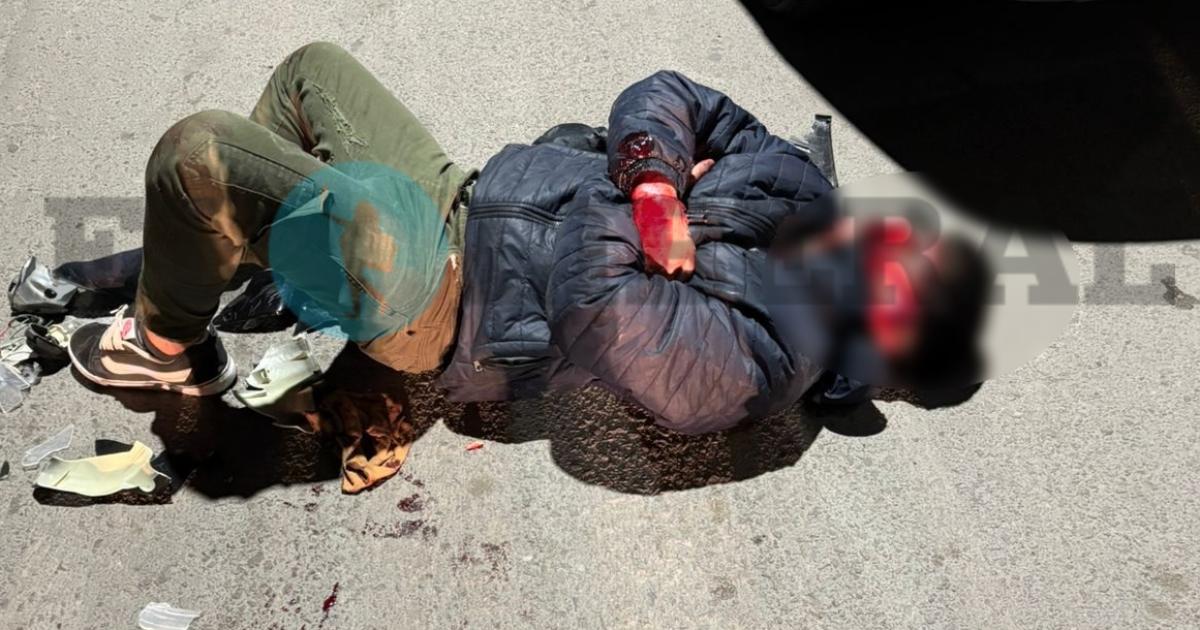 Saacutebado accidentado- joven pisteaba por la Aguirre intentoacute un willy rozoacute un auto y acaboacute con la cara ensangrentada