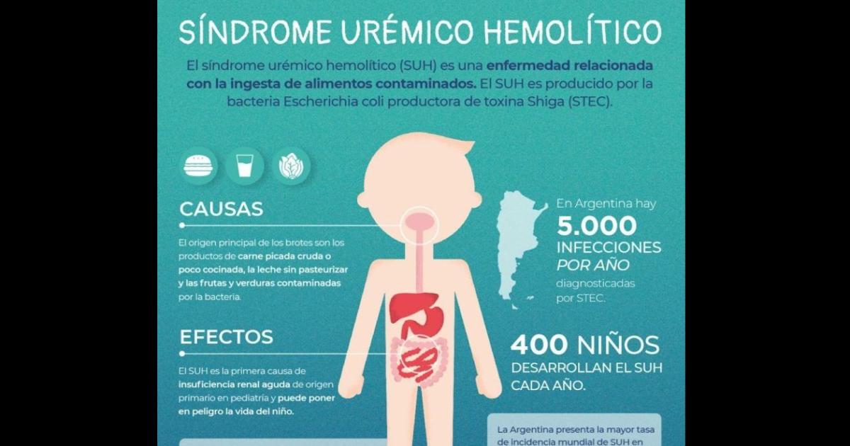 PATOLOGÍA El Síndrome Urémico Hemolítico puede prevenirse con simples acciones en el hogar