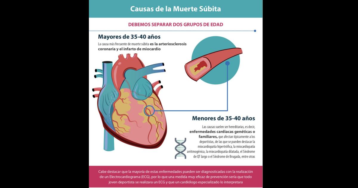 Muerte sbita- es vital reconocer los síntomas e identificar los pasos de la cadena de vida