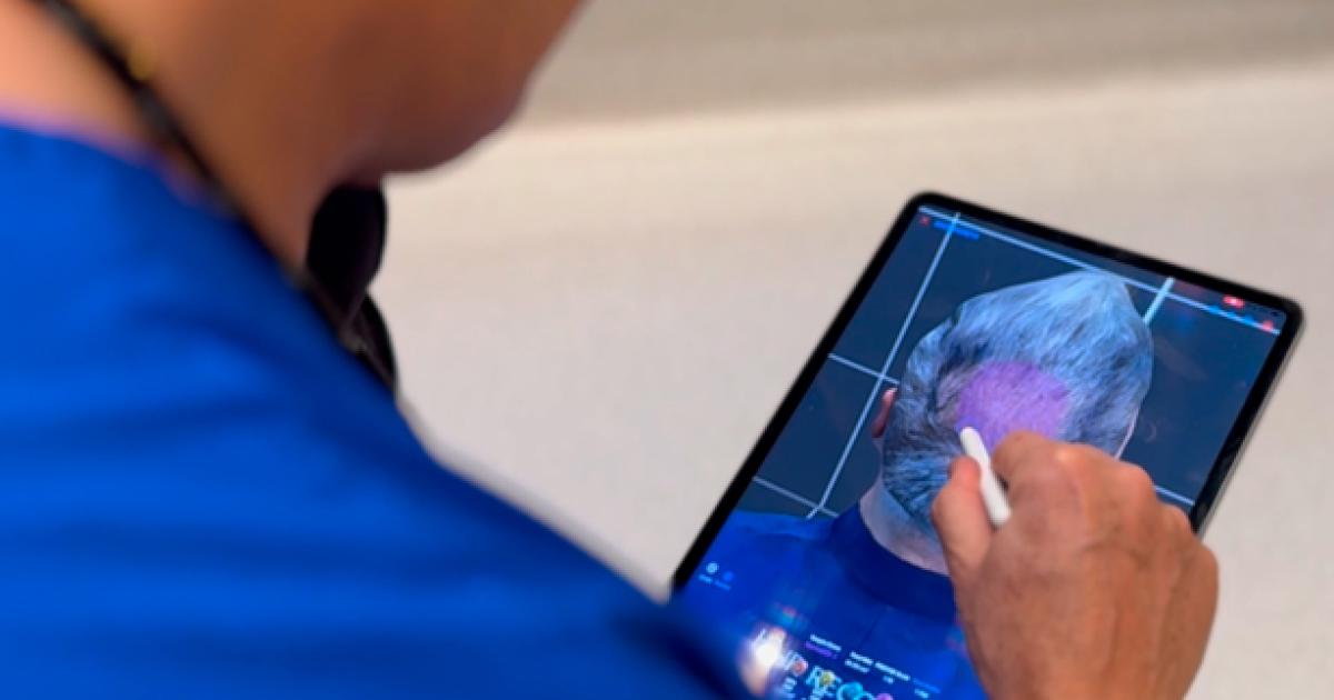 Hair Recovery lanza exclusivo diagnoacutestico capilar con Inteligencia Artificial