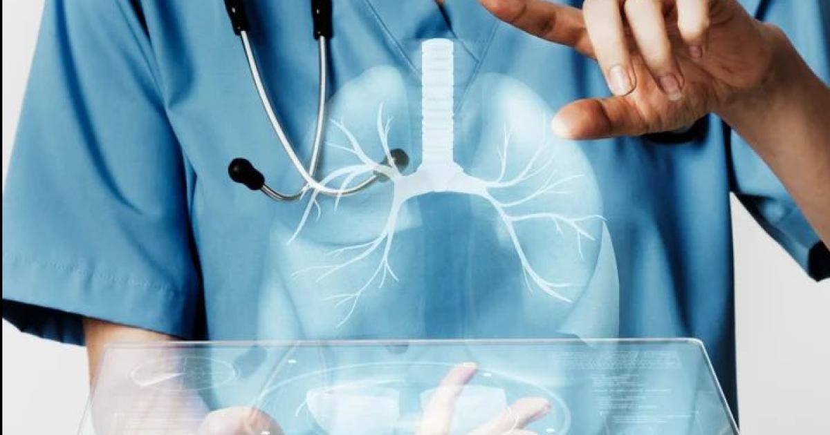 INCIDENCIA En la Argentina la fibrosis quística tiene una prevalencia de uno en cada 6700 nacimientos