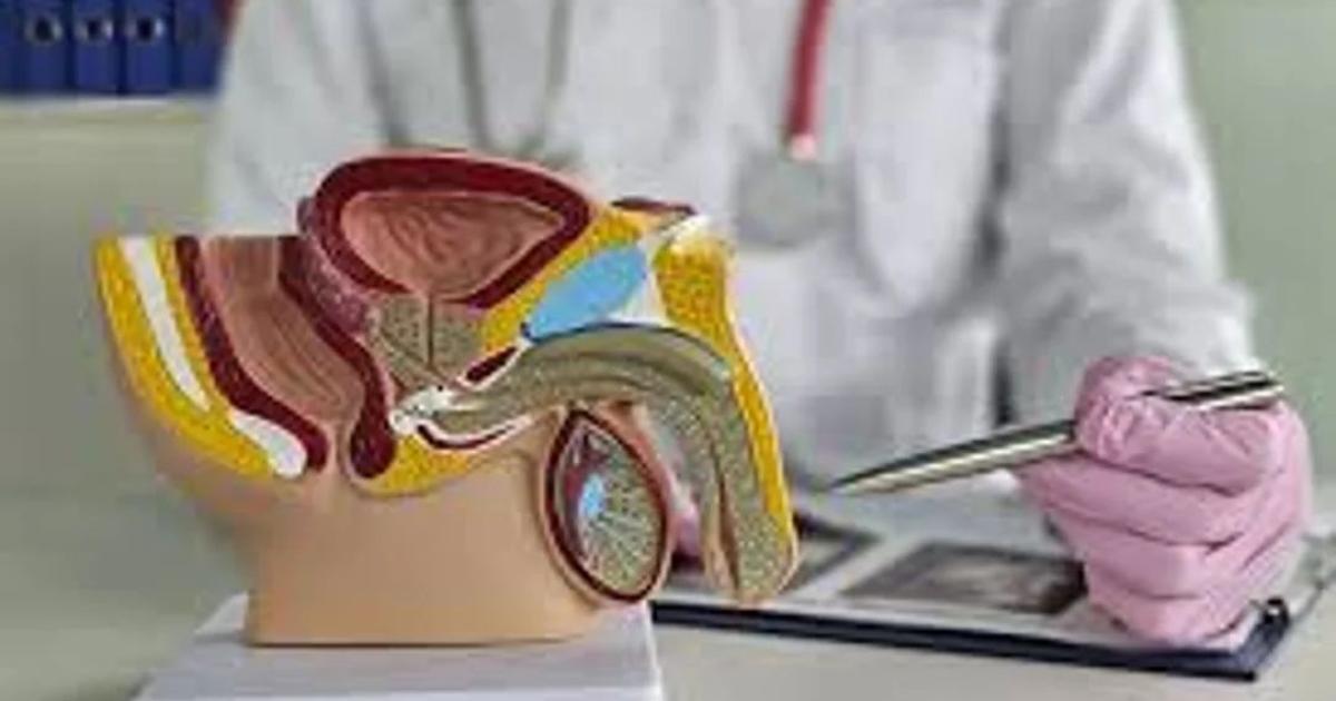 Revelaron que cada vez ms pacientes buscan revertir la vasectomía en Argentina