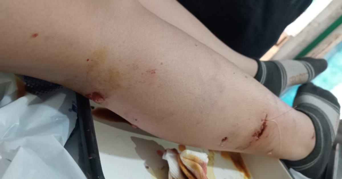 LESIONES Hijo y Madre recibieron golpes y sufrieron heridas en sus cuerpos