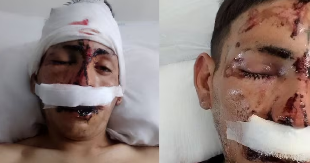  La víctima fue identificada como Luciano Maidana de 25 años