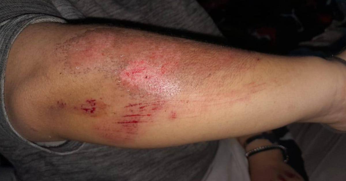 Motochorros atacaron a una pareja en Ruta 1- acabaron derrapando y cayendo sobre el asfalto