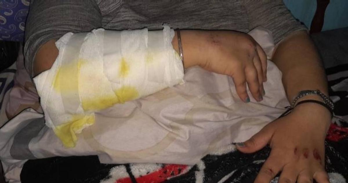 Motochorros atacaron a una pareja en Ruta 1- acabaron derrapando y cayendo sobre el asfalto