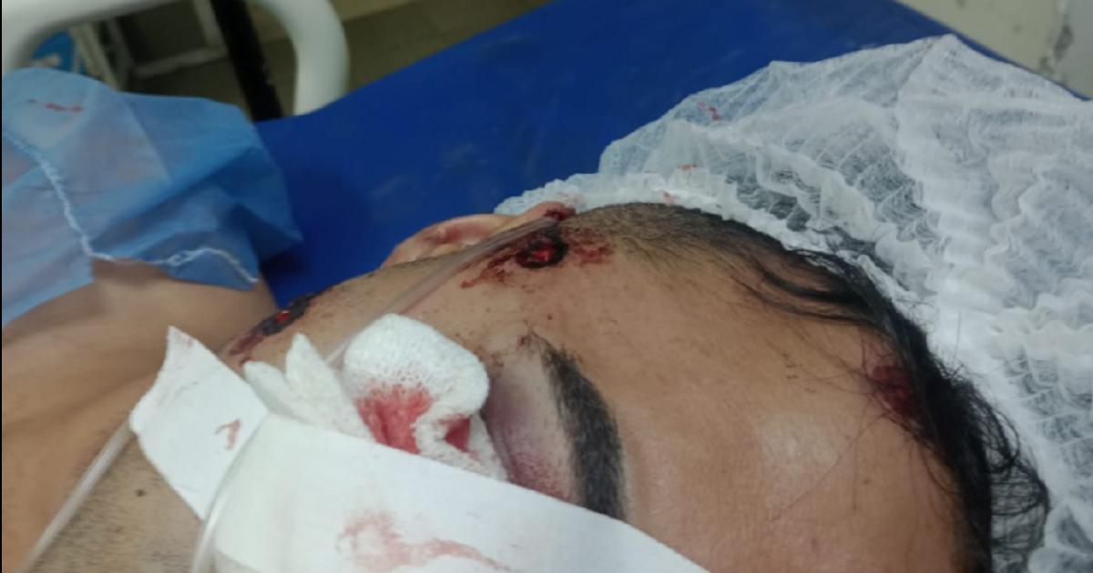 Un joven perdioacute un ojo tras recibir un disparo de bala de goma en un operativo policial