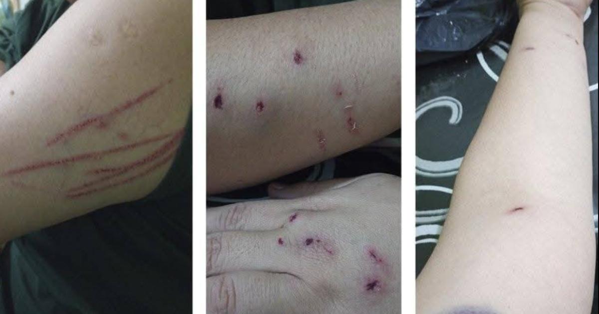 Una mujer fue torturada abusada y le robaron el celular