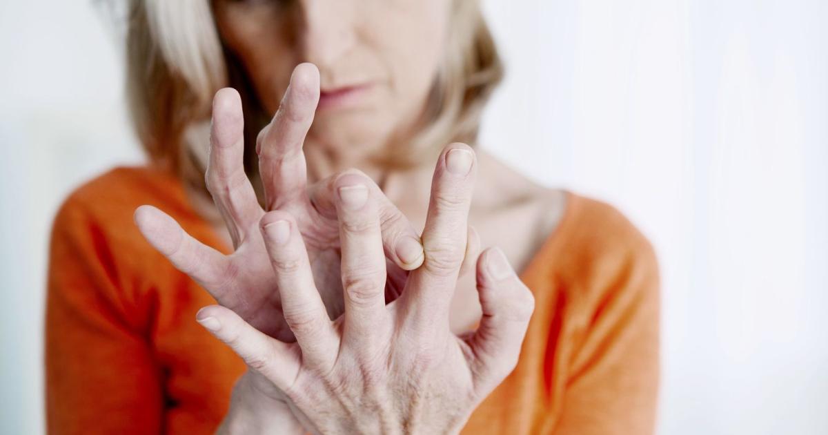 iquestPor queacute es importante el diagnoacutestico precoz para los pacientes con artritis reumatoidea