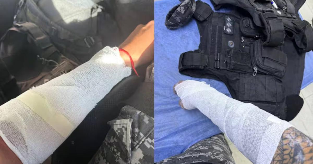 Las heridas que sufrió uno de los policías (Foto- Policía de Córdoba)