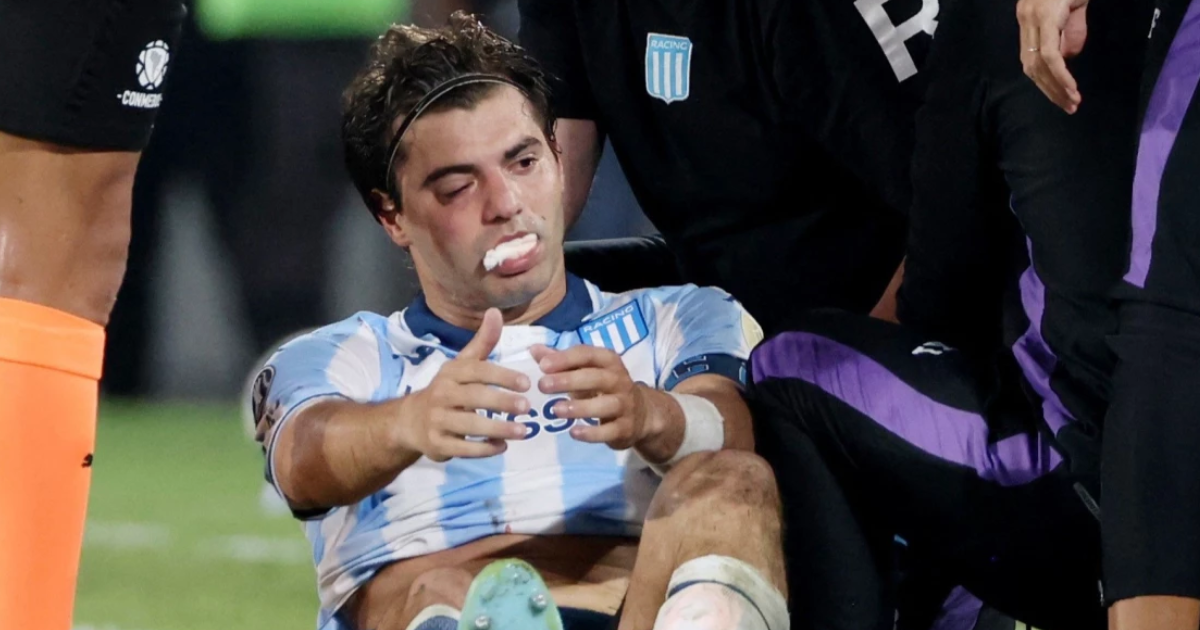 Por el codazo de Marcos Rojo Santiago Sosa sufrioacute una fractura y no volveriacutea a jugar hasta 2026