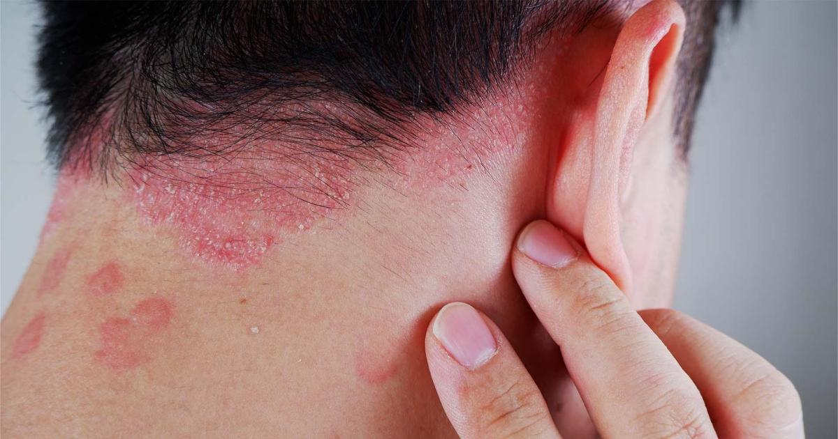 29 DE OCTUBRE Día mundial de la enfermedad