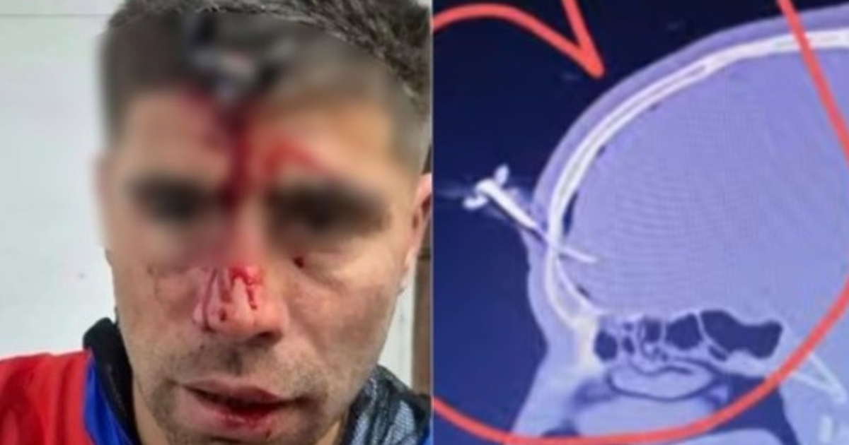 iexclDejen de pegarle- el desesperado relato de la mujer que vio coacutemo le clavaron una llave en la cabeza a su marido