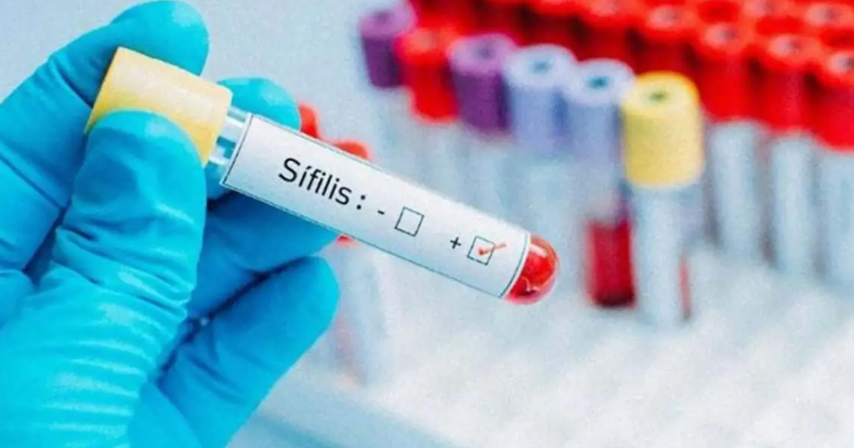 Alerta por el aumento de Siacutefilis en Argentina- cuaacutel es la provincia maacutes afectada