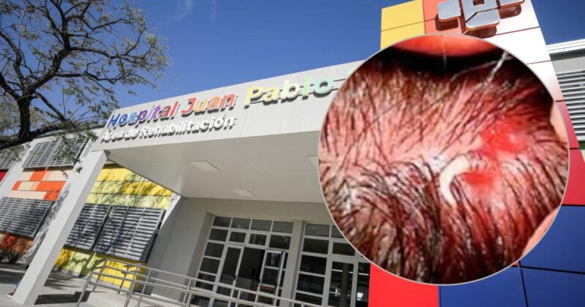 Una nintildea llegoacute al hospital Pediaacutetrico con gusanos en la cabeza