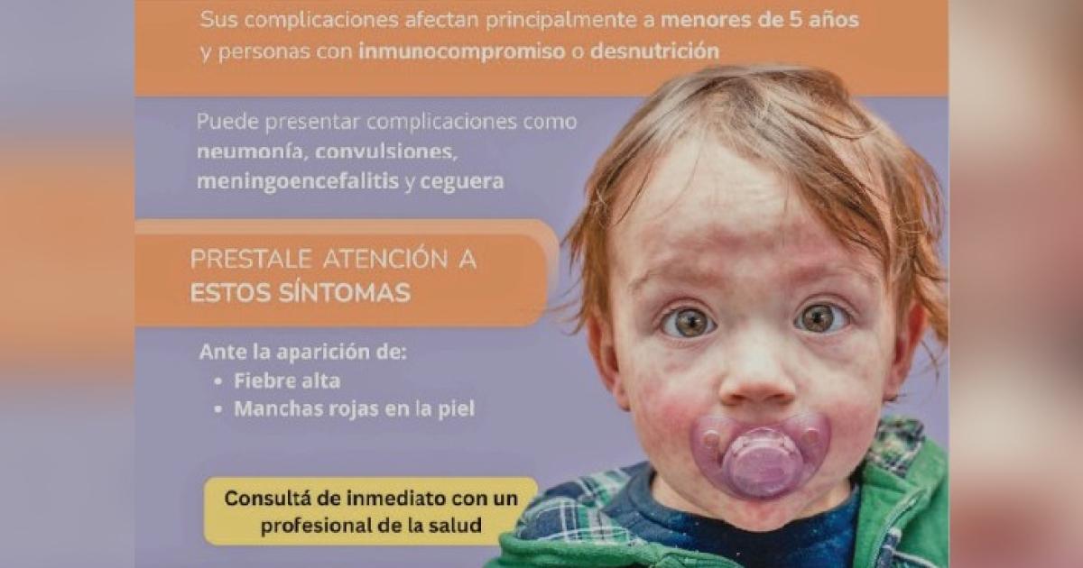 Alerta sarampioacuten- el Ministerio de Salud de Santiago pide completar el carnet de vacunacioacuten