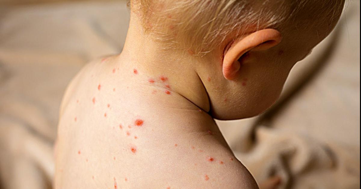 Capacitacioacuten del programa Oncologiacutea Eficiente