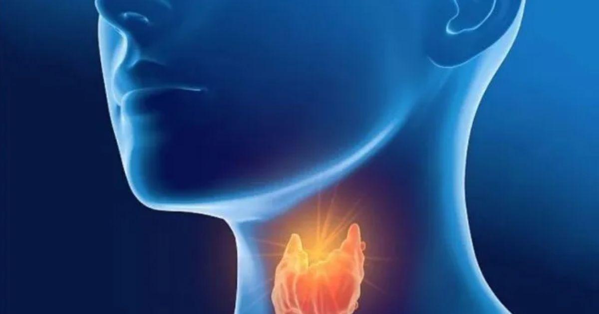 Hipotiroidismo en el adulto- queacute tener en cuenta para un tratamiento adecuado