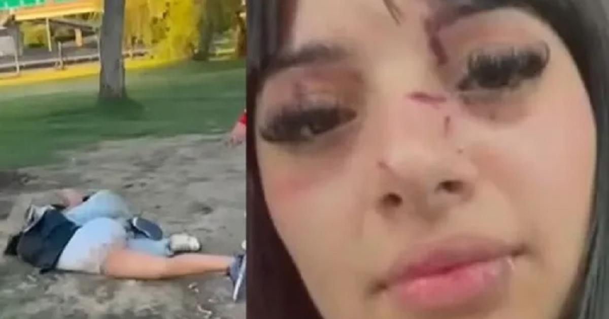 Brutal ataque a una joven influencer a la salida de un boliche 