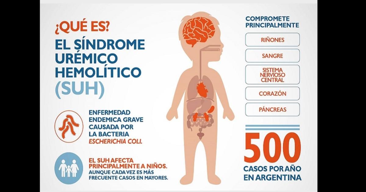 ENFERMEDAD Afecta principalmente a niños menores de 5 años