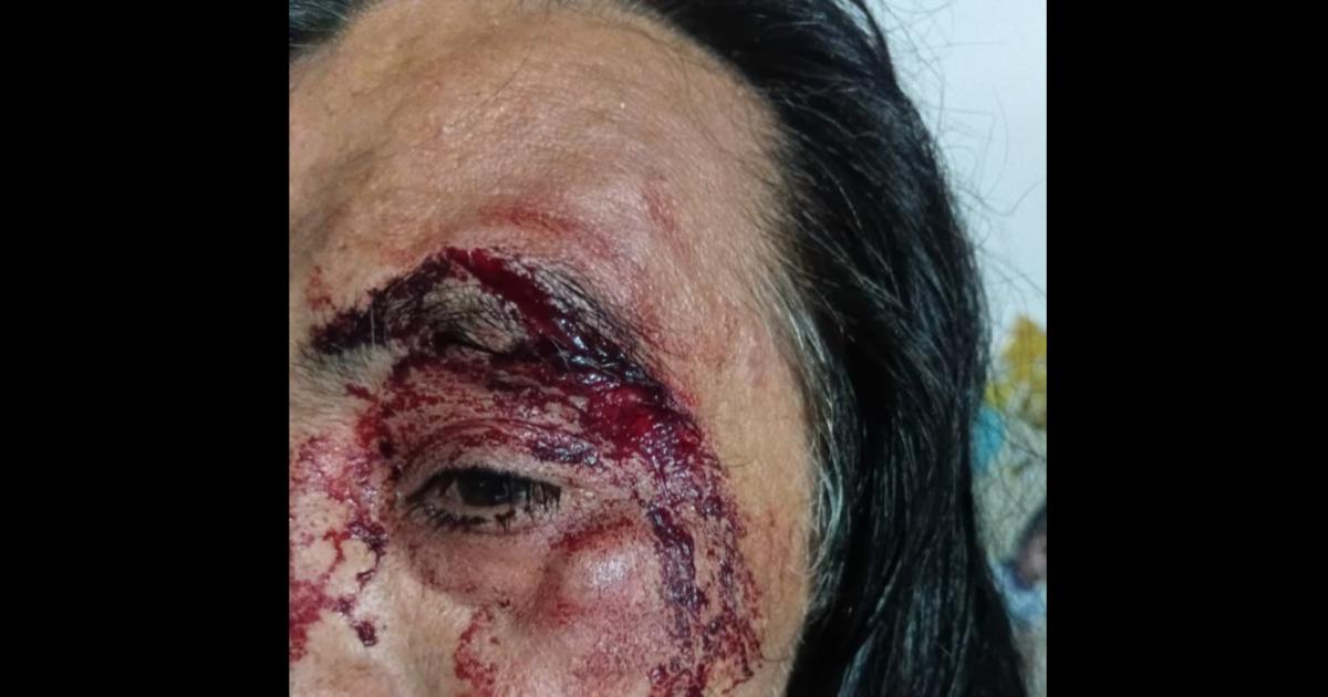 Terror en Antildeatuya- le gritoacute dame todo y lo molioacute a golpes en plena avenida 25 de Mayo