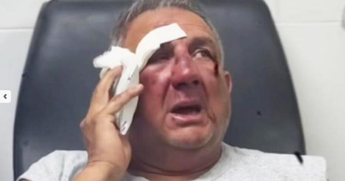 Violento asalto a taxista- lo ahorcaron con un cable y le robaron el auto - Foto- Contexto Tucumn