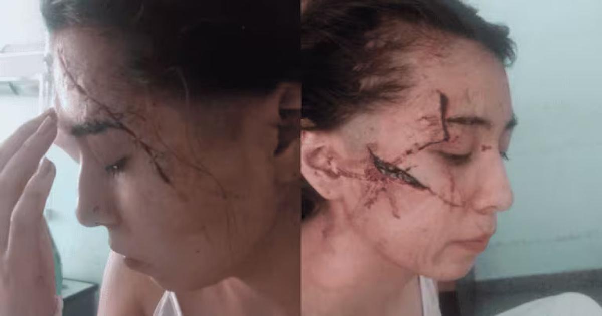 Brutal ataque en patota a una chica viacutectima de bullying- La intencioacuten era cortarle el cuello