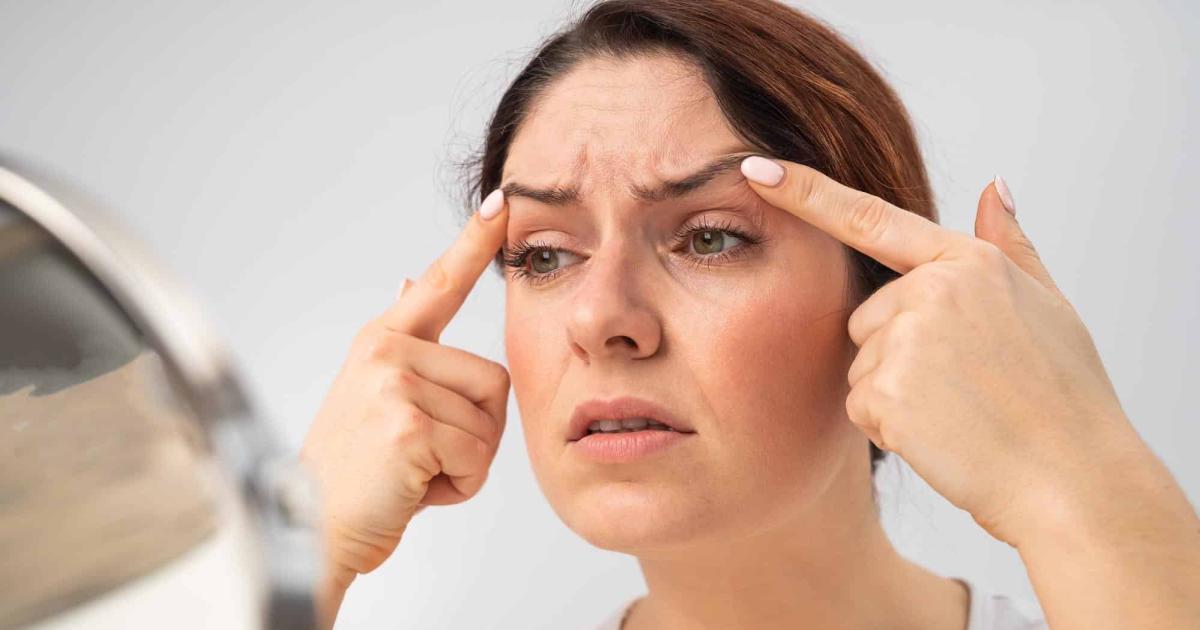 Ojos y paacuterpados hinchados- causas y tratamientos