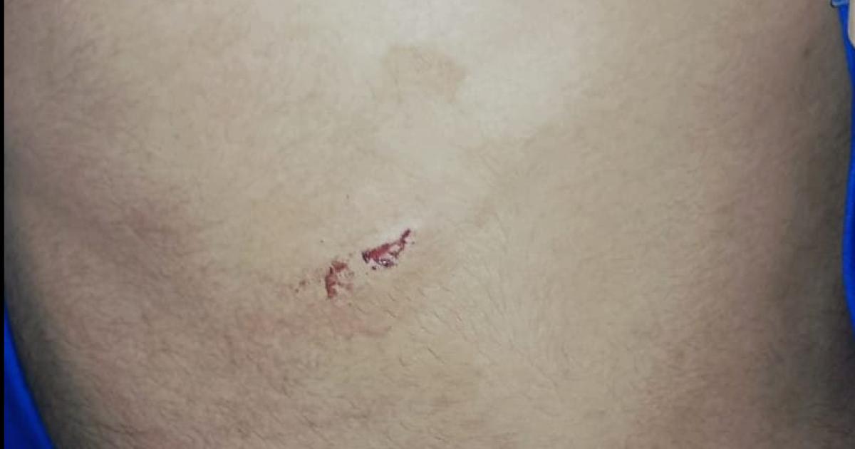 Lo interceptan en la calle y lo acuchillan- seriacutea por un ajuste de cuentas