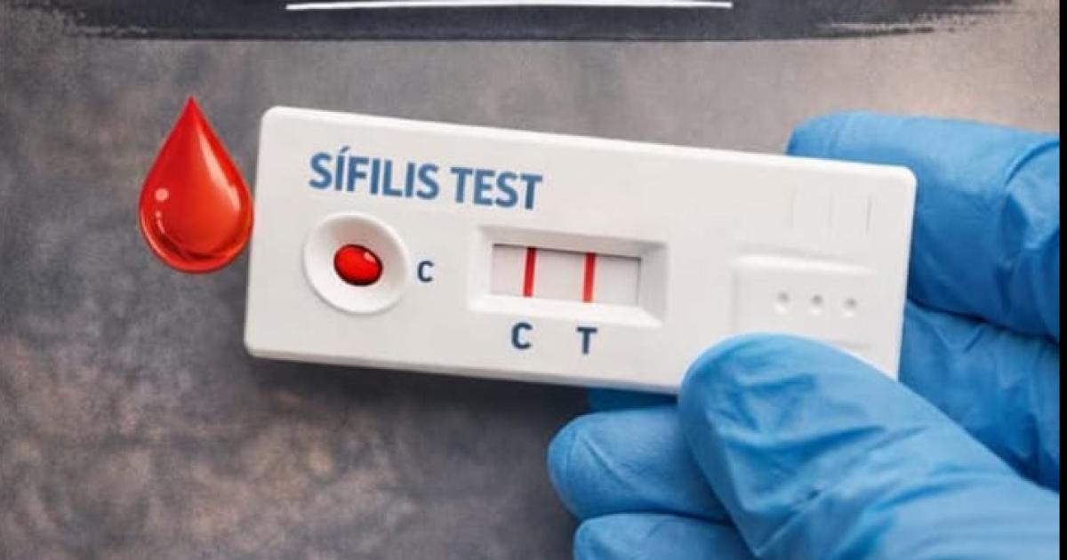 La deteccioacuten precoz de VIH y siacutefilis posibilita el acceso oportuno al tratamiento y seguimiento
