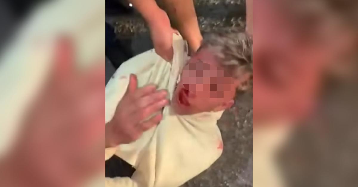 Persecución caída y linchamiento- vecinos frustraron un violento intento de robo - Foto captura- Facebook Faimall� Noticias