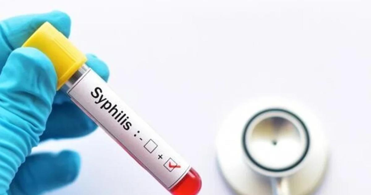 DOLENCIA Se transmite de persona a persona