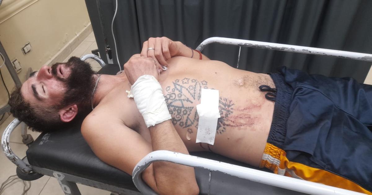 DIRECTO AL HOSPITAL- Beliz�n fue conducido de inmediato al Regional En tanto su hermano persiguió a dos presuntos agresores Estalló una batahola en casa ajena para lamento de su propietario