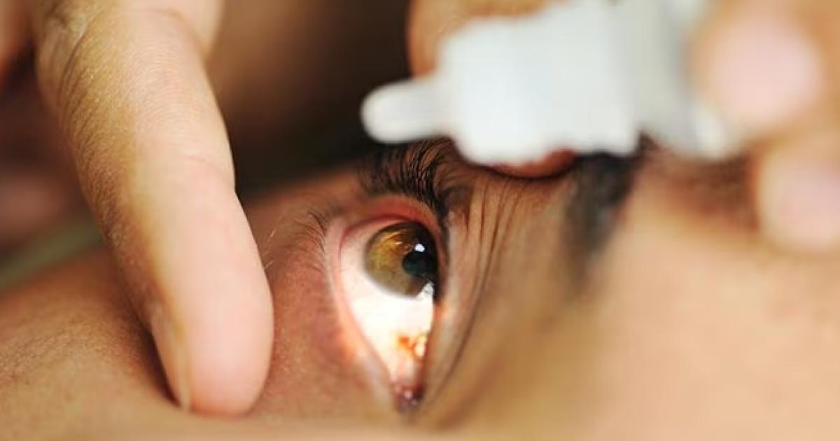 iquestQueacute es el glaucoma- por queacute deberiacutea importarme y tomar los recaudos necesarios