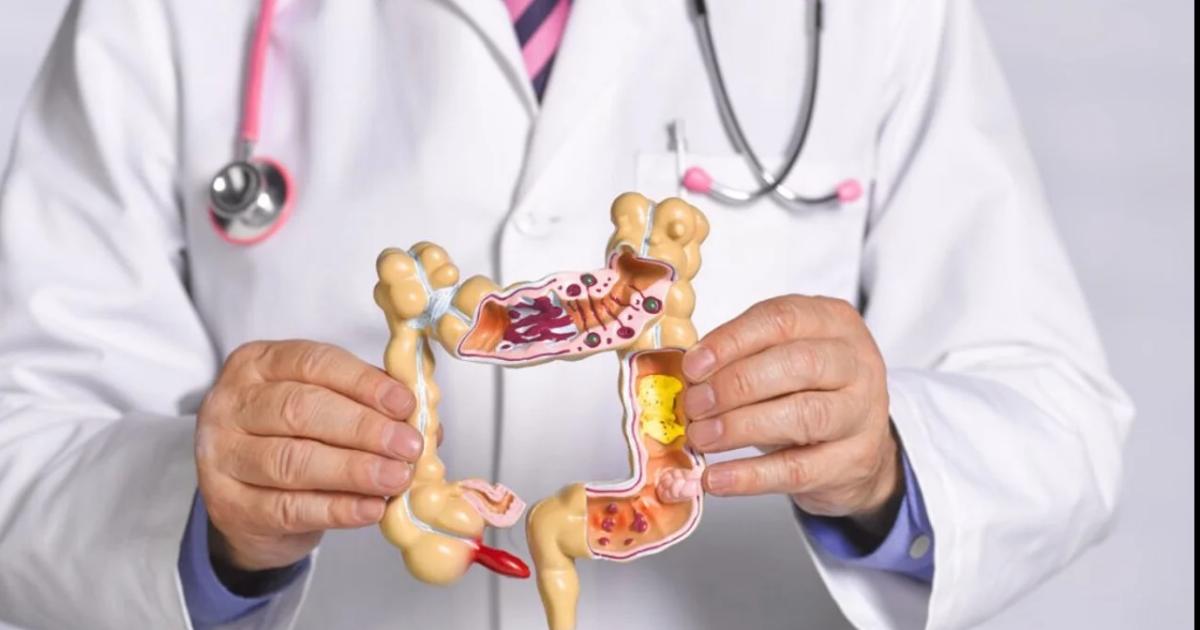 ESTADÍSTICA En Argentina se detectan m�s de 15000 casos nuevos por año