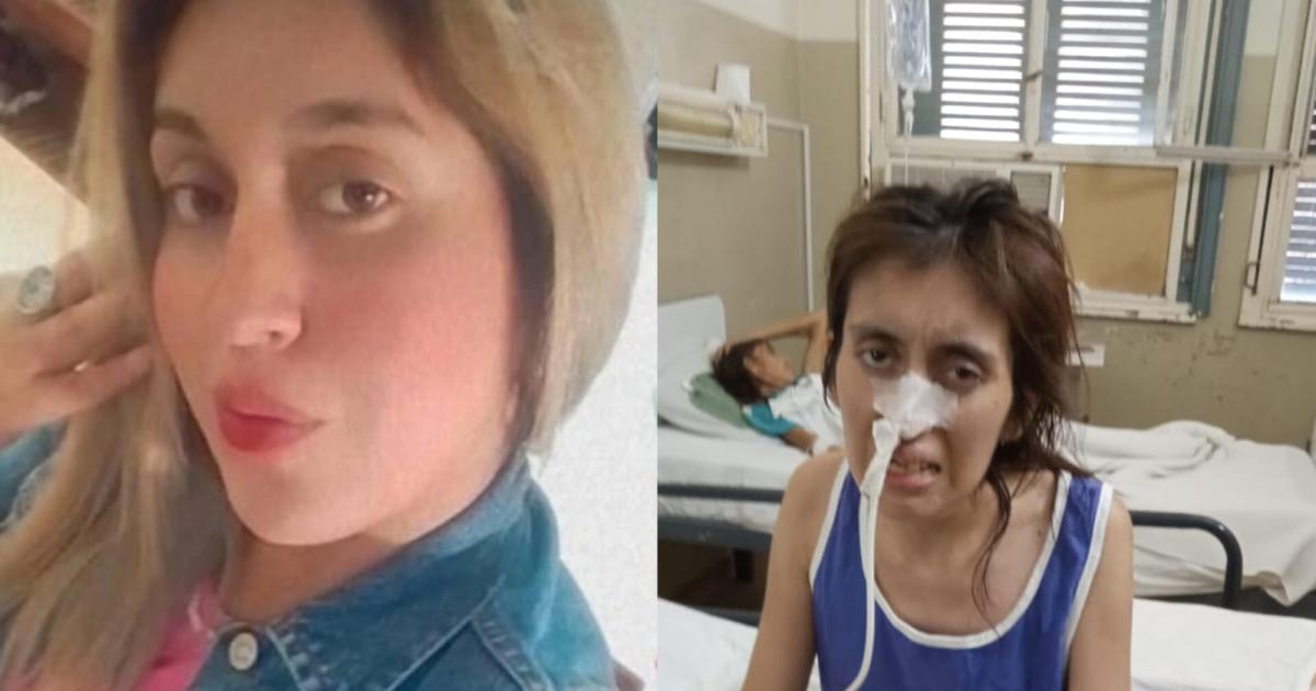 ANTES Y DESPUÉS La salud de Marita se fue deteriorando a raíz de los lesiones
